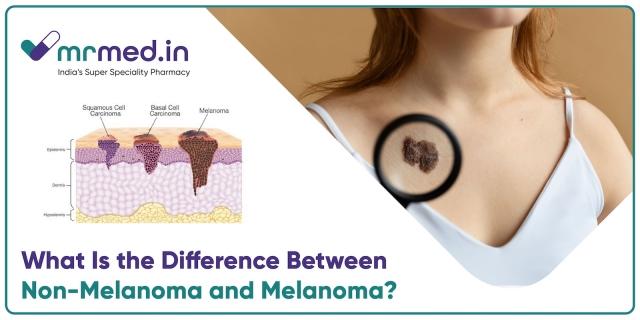 Melanoma vs. Non-Melanoma: Understanding the Different Types of Skin Cancer